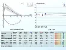 Vyntus_spiro_pc_image_carousel_3