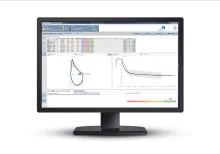 A computer screen showing charts