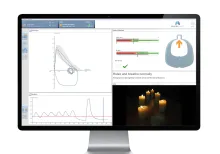 Vyntus Spiro Carousel 2