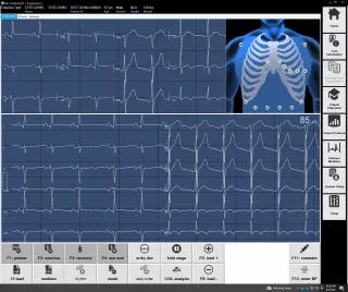 CardioSoft_Ecg_image_1