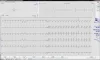 CardioSoft_Meas_Grey_EN